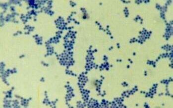 禽类葡萄球菌病传染途径有哪些,鸭葡萄球菌病有何发病特点